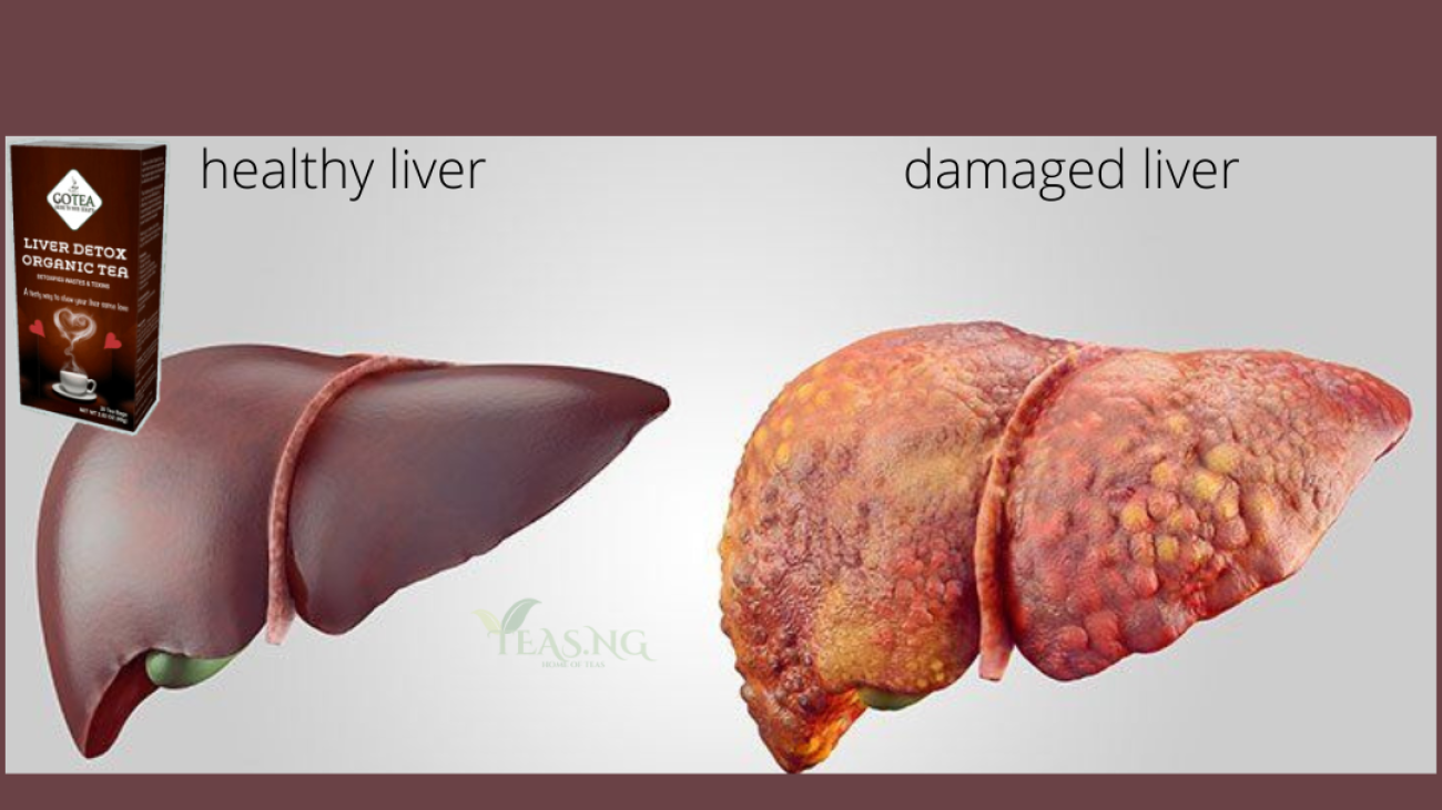 damaged liver
